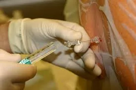 anaes